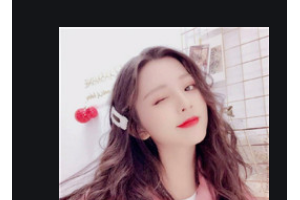 南京卡瓦口腔門診部高德國整形價(jià)格表附金屬托槽矯正案例展示