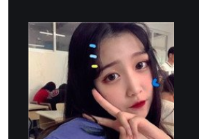 江西省婦幼保健院醫(yī)學(xué)美容科付時章整形價格表附顴骨顴弓整形術(shù)案例展示