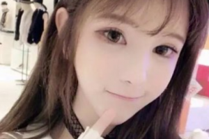 江西博愛眼科醫(yī)院陳小娟整形價格表附切開雙眼皮案例展示