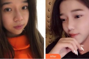 成都艾尚醫(yī)學(xué)美容門診部嚴新整形價格表附祛斑案例展示