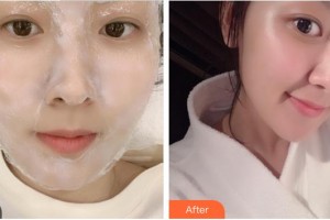 成都漢密爾頓美容醫(yī)院石曉軍整形價格表附點(diǎn)陣激光案例展示