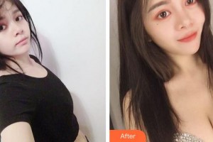 成都莊醫(yī)生醫(yī)學(xué)美容診所楊瀚城整形價格表附隆胸案例展示