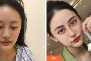 成都悅好醫(yī)學美容醫(yī)院韓炯逸整形價格表附鼻部手術案例展示