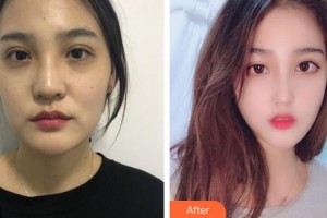 成都臺美仁仁醫(yī)學美容診所柯樹英整形價格表附鼻部手術案例案例展示