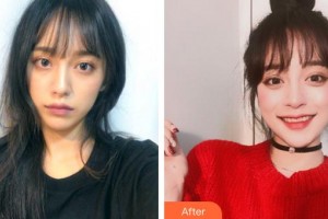 成都米蘭柏羽醫(yī)學(xué)美容醫(yī)院唐桂茹整形價格表附光子嫩膚案例展示