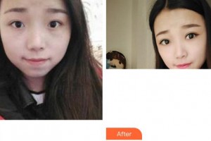 成都美容整形醫(yī)院沈燕華整形價格表附眼部綜合案例展示