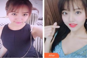 成都華顏醫(yī)療美容門診部宋俊林整形價(jià)格表附隆胸案例展示