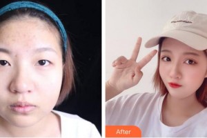 成都醫(yī)美整形美容醫(yī)院許文萍整形價(jià)格表附眼部綜合案例展示