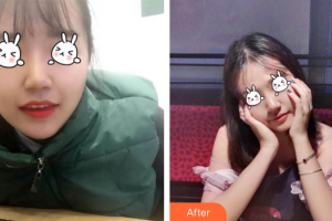 廣州曙光醫(yī)學(xué)美容醫(yī)院李承新整形價格表附無針?biāo)獍咐故?>
</a>
<h3 class=