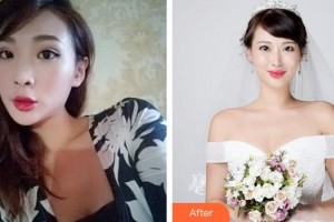 成都素美醫(yī)療美容診所李競(jìng)整形價(jià)格表附鼻部綜合案例展示