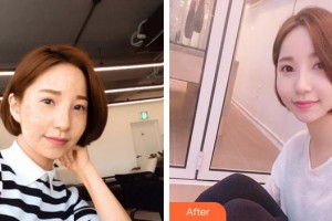 成都柏菲絲醫(yī)學(xué)美容門診部唐豪悅整形價格表附果酸祛痘案例展示