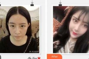 成都圣形醫(yī)療美容診所陳強(qiáng)整形價(jià)格表附眼部整形案例展示