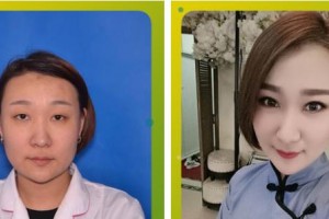 成都瑞美薈醫(yī)療美容醫(yī)院胡杰整形價(jià)格表附眼部綜合案例展示