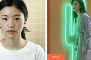 成都如悅醫(yī)療美容醫(yī)院李洋整形價(jià)格表附面部輪廓案例展示