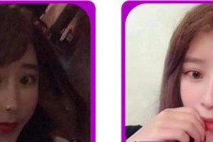 成都修膚堂皮膚病診所唐紅霞整形價(jià)格表附果酸換膚案例展示