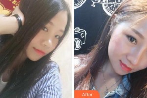 成都科思研醫(yī)療美容診所代維整形價(jià)格表附鼻部整形案例展示