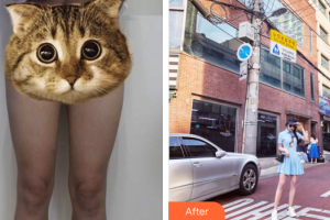 廣州晨曦醫(yī)療美容醫(yī)院李碩埈整形價格表附美體塑形案例展示