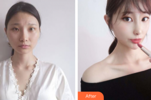 廣州軍區(qū)武漢總醫(yī)院醫(yī)學整形美容中心胡山整形價格表附面部吸脂案例展示