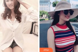 成都晶都醫(yī)療美容醫(yī)院王教授整形價格表附豐胸案例展示