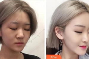 成都暄妍醫(yī)療美容門診部潘寧整形價格表附鼻部手術整形案例展示