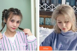 成都瑞麗詩美學植發(fā)門診部尚俊整形價格表附發(fā)際線案例展示