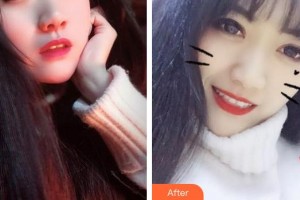 成都茁悅口腔診所李琴整形價格表附牙齒美白案例展示