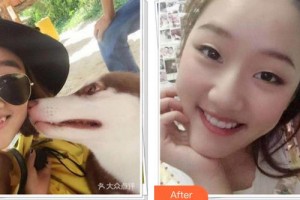 成都茁悅口腔診所曾紅整形價格表附牙齒矯正案例展示