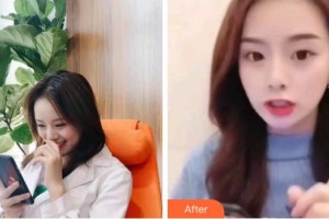 成都華西牙種植醫(yī)院易新竹整形價格表附超聲波潔牙案例展示