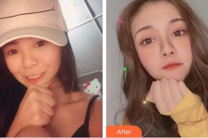 成都華蜀眼科門(mén)診部陳來(lái)華整形價(jià)格表附眼部綜合案例展示