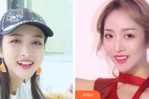 成都圣貝牙科醫(yī)院朱海整形價(jià)格表附牙齒矯正案例展示