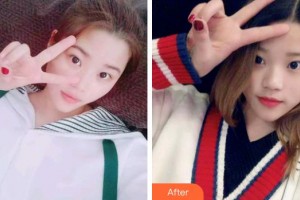 成都純?？谇辉\所馬華鈺整形價(jià)格表附冷光美白案例展示