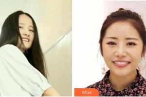 成都皓雅口腔門診部陸相華整形價(jià)格表附牙綜合案例展示