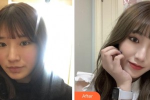 福建武警總隊醫(yī)院激光美容中心余文杰整形價格表附美白嫩膚案例展示