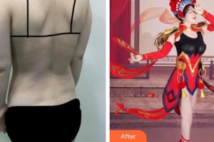 福建省人民醫(yī)院整形中心鐘盛全整形價格表附全身吸脂案例展示