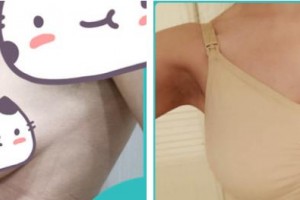 福州中意醫(yī)療美容門診部羅永萍整形價(jià)格表附豐胸案例展示