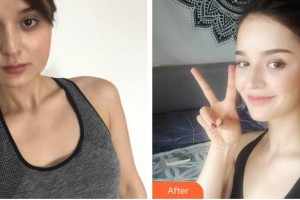 福州愛(ài)思特醫(yī)療美容醫(yī)院曾小梅整形價(jià)格表附激光美膚激光祛斑案例展示