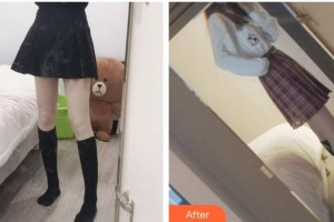 福州隆美爾整形美容醫(yī)院王楨整形價(jià)格表附大腿吸脂案例展示