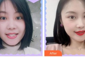 福州曙光整形美容醫(yī)院王斌整形價(jià)格表附隱形矯正案例展示