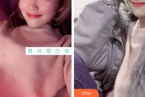 福州格萊美醫(yī)療美容醫(yī)院果輝整形價(jià)格表附口腔案例展示