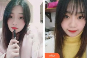 福州同福醫(yī)口腔門診部謝賢波整形價(jià)格表附牙齒矯正案例展示