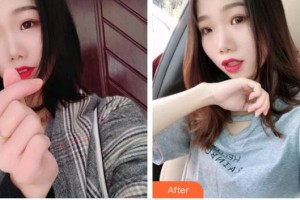 福州愛(ài)尚貝臣口腔門診部穆素花整形價(jià)格表附超聲波潔牙案例展示