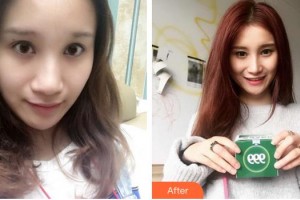 廈門歐韻艷軍醫(yī)療美容診所叢艷軍整形價格表附鼻部整形案例展示