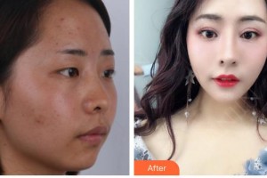 廈門蔡懿醫(yī)療美容診所支婷整形價格表附抗衰案例展示