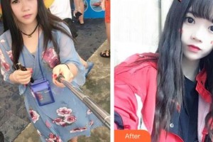 廈門大學(xué)附屬廈門眼科中心醫(yī)院伍端曉整形價格表附切開雙眼皮案例展示