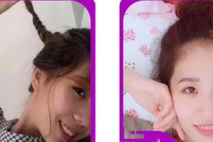 廈門卓爾口腔門診部江春松整形價(jià)格表附隱形矯正牙齒案例展示