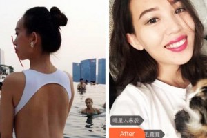 廈門峰煜口腔門診部林光毅整形價格表附牙齒矯正案例展示