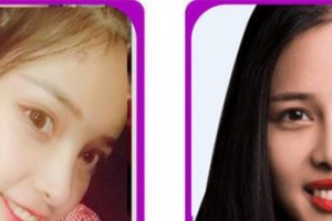 廈門康爾口腔門診部蘇明真整形價格表附牙齒貼面案例展示