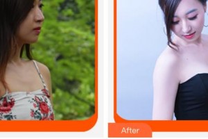 莆田海峽整形美容醫(yī)院田新海整形價格表附假體隆胸案例展示