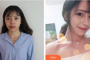 三明萬國美萊醫(yī)療美容外科門診部柯于清整形價格表附隆鼻修復(fù)案例展示