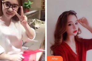 泉州美萊華美整形美容醫(yī)院趙正杰整形價格表附鼻部綜合案例展示